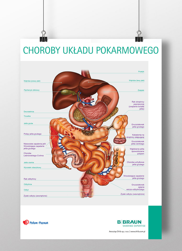 plakat bbraun